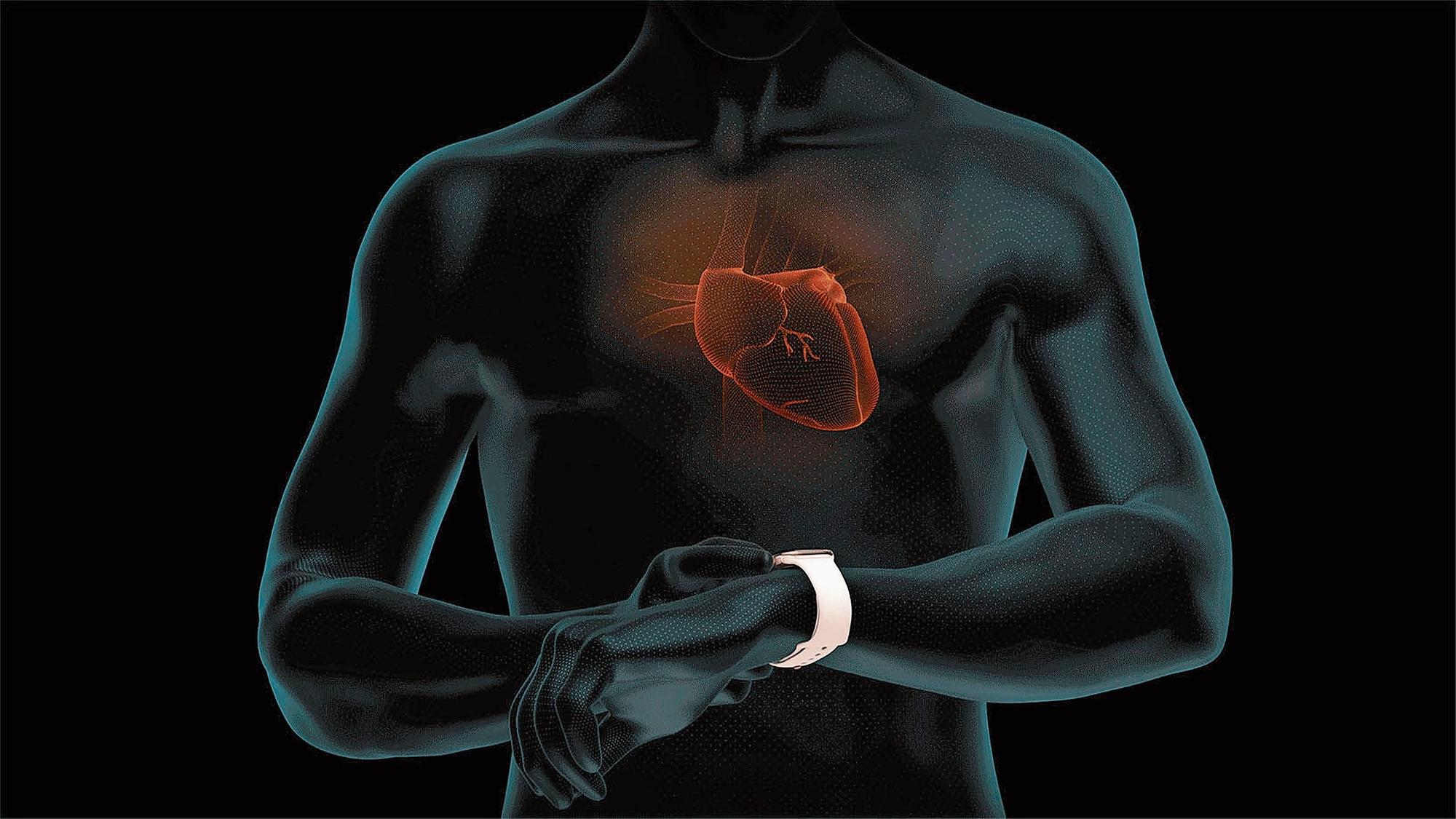 Mobiles Ekg Spurt Vorhofflimmern Auf Luzerner Kantonsspital