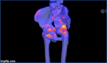SPECT/CT GIF Animated