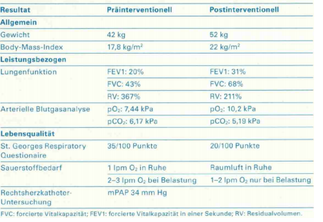 Tabelle