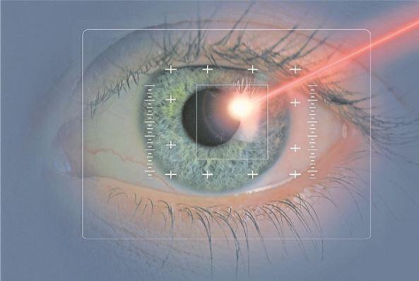 4000 Schweizerinnen und Schweizer lassen sich jährlich die Augen lasern.thinkstock