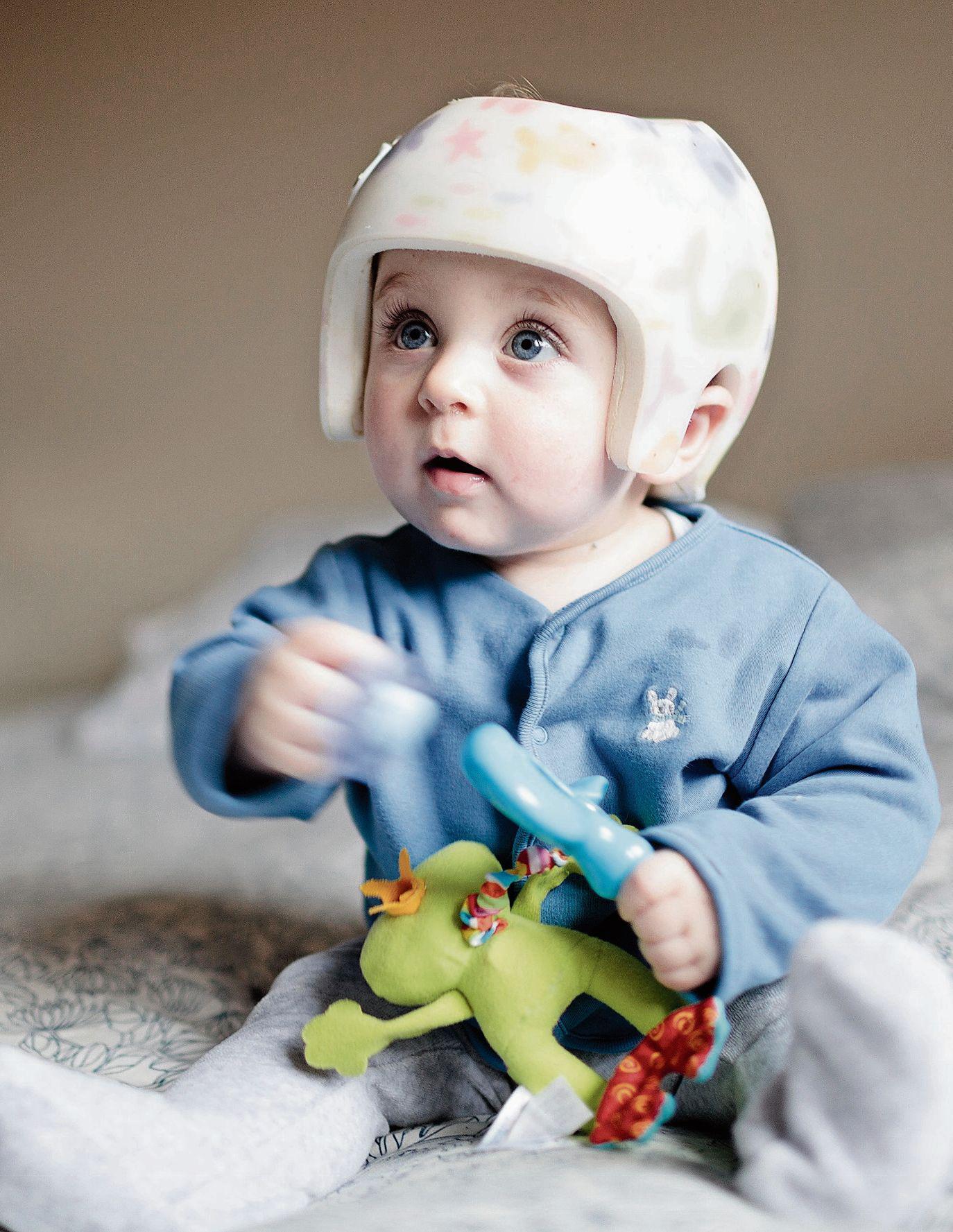 Ein Helm kann mithelfen, Kopfdeformitäten beim Kleinkind auszugleichen. (Bild: Getty)