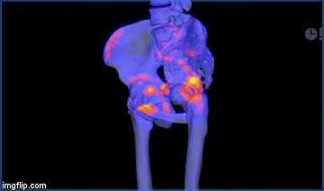 CT GIF Animated