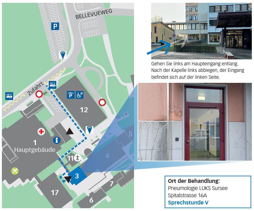 kontakt und anreise pneumologie sursee