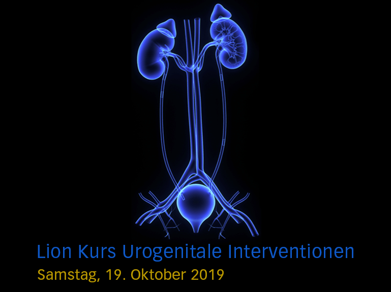urogenitale intervention titelbild urogenitale intervention titelbild