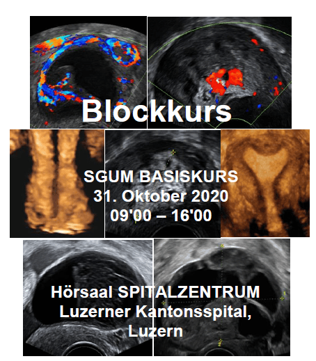 Blockkurs GYNÄKOLOGISCHER ULTRASCHALL window 2020 04 06 07 56 10